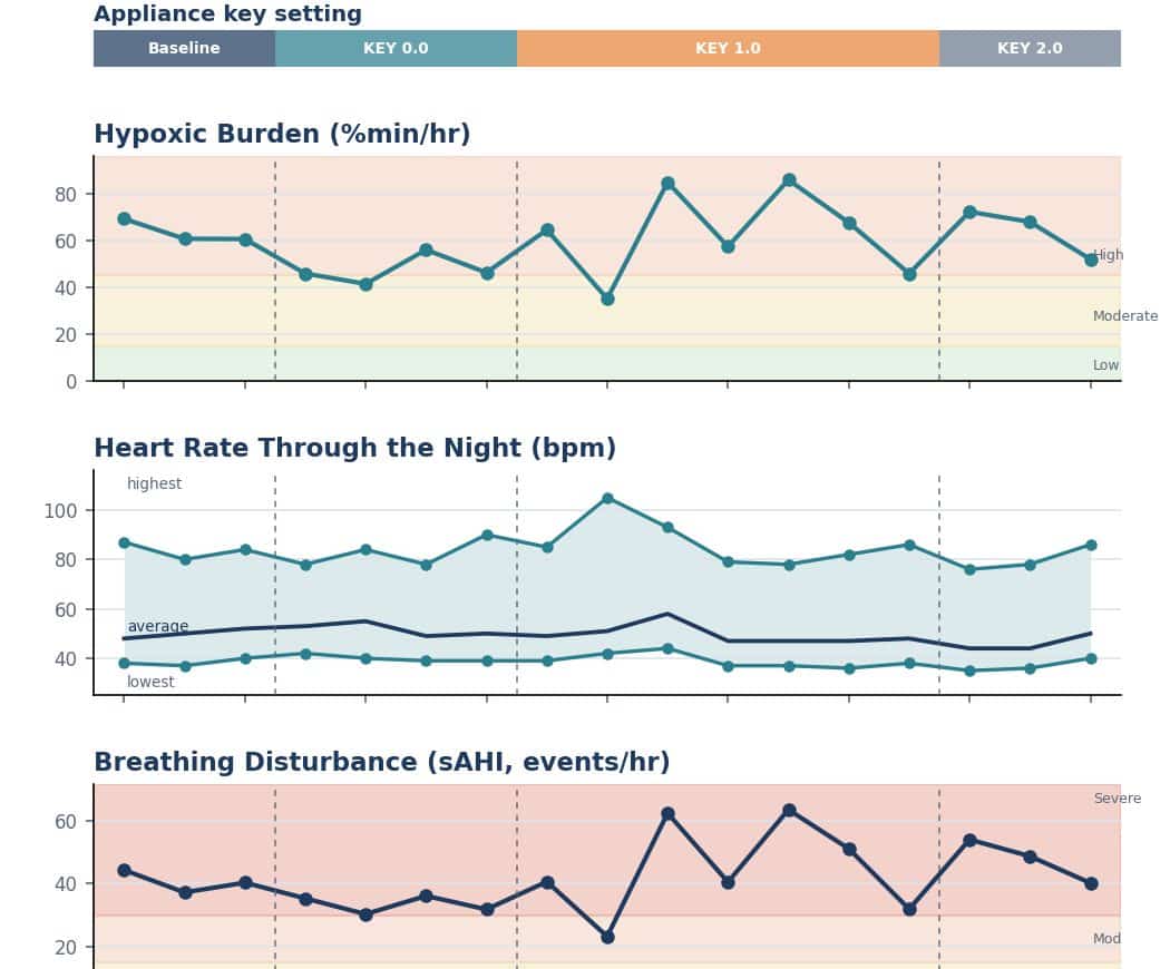 Seventeen nights of hypoxic burden, heart rate and breathing disturbance with the setting bands marked; the numbers do not fall as the setting advances